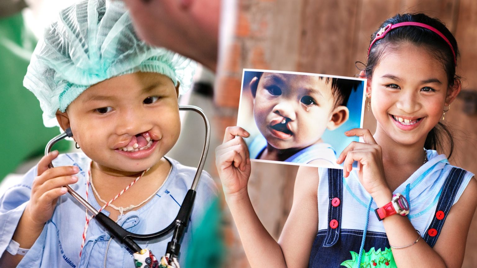 มูลนิธิฟูจิฟิล์ม บิสซิเนส อินโนเวชั่น (ประเทศไทย) เดินหน้าช่วยเหลือผู้ป่วยปากแหว่งเพดานโหว่ทั่วประเทศ